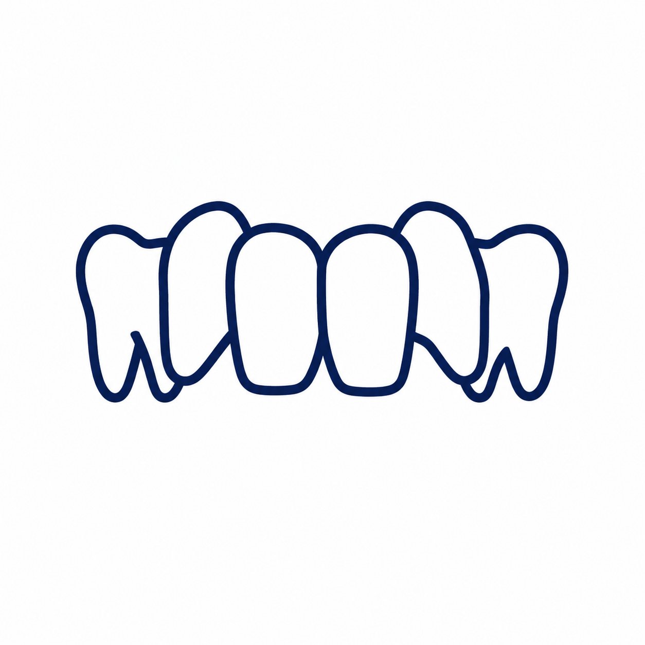 Crowded Teeth