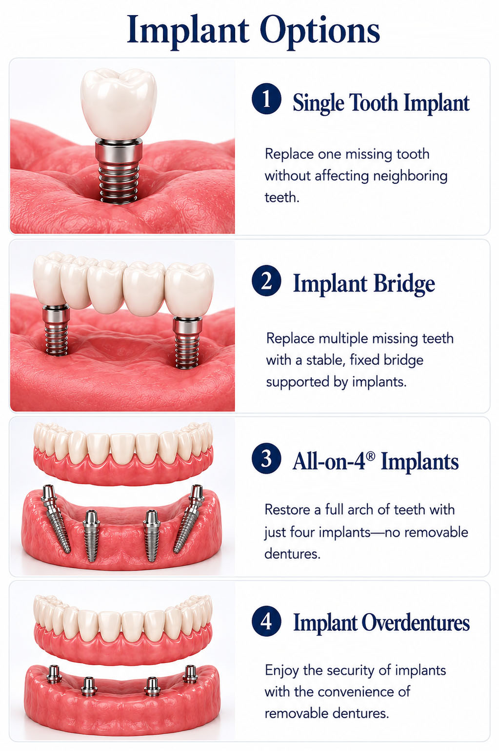 Implant Options
