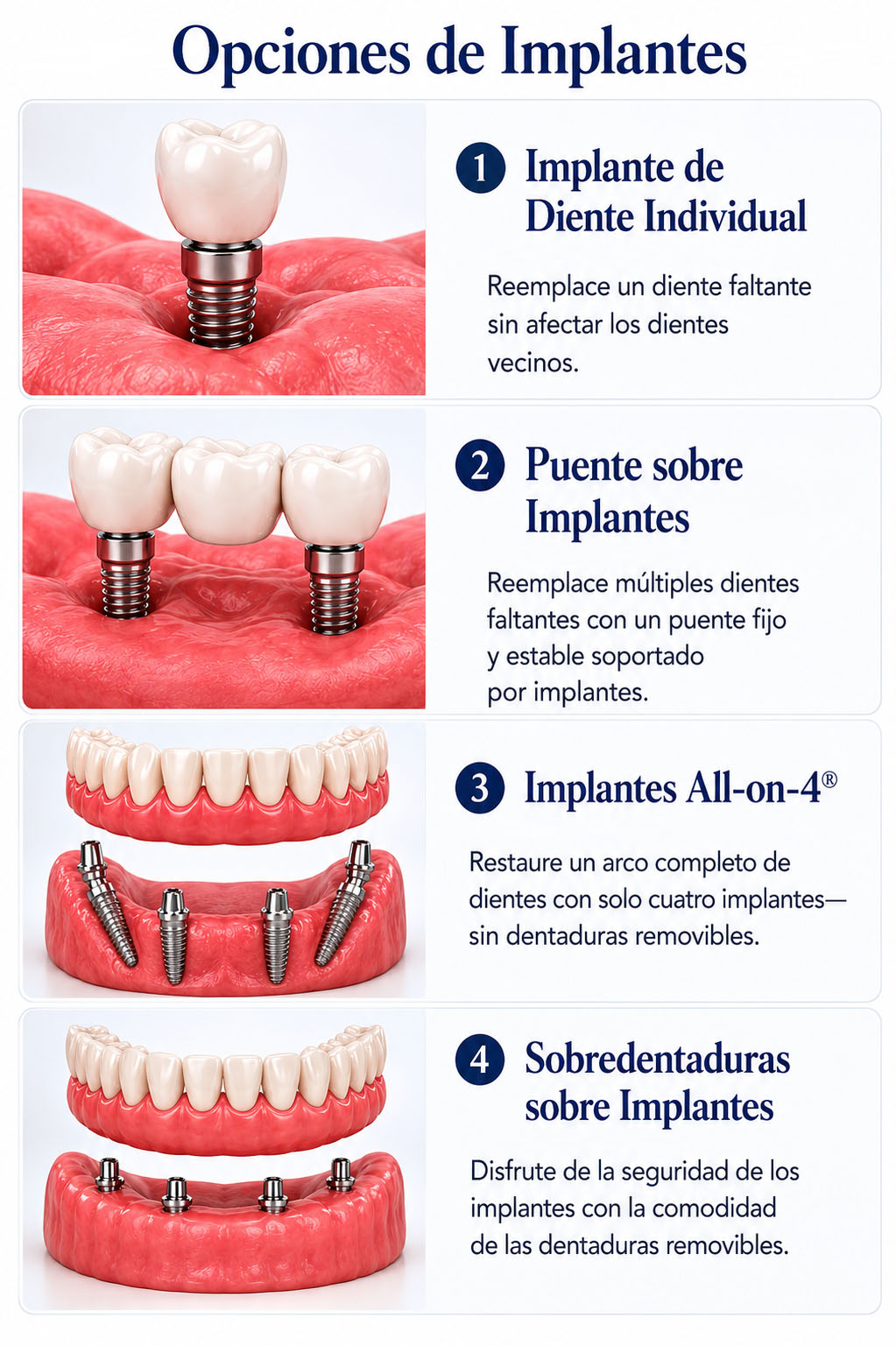 Opciones de Implantes