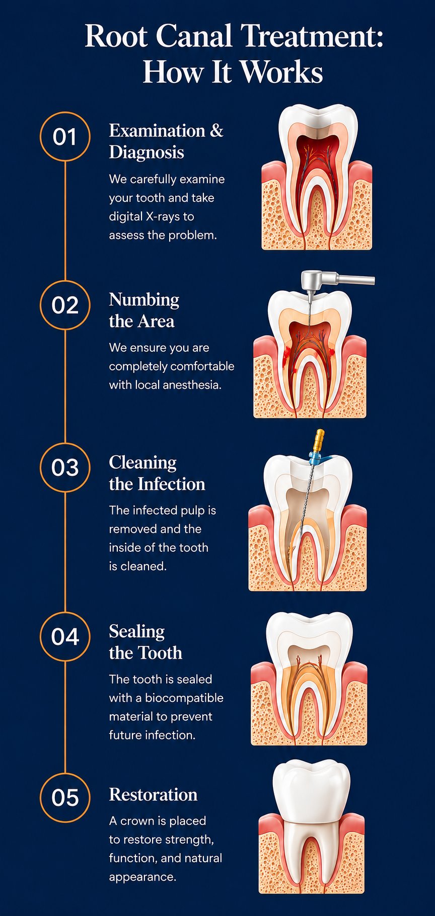 Root Canal Treatment: How It Works